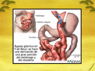 18 Sobrepeso y Obesidad