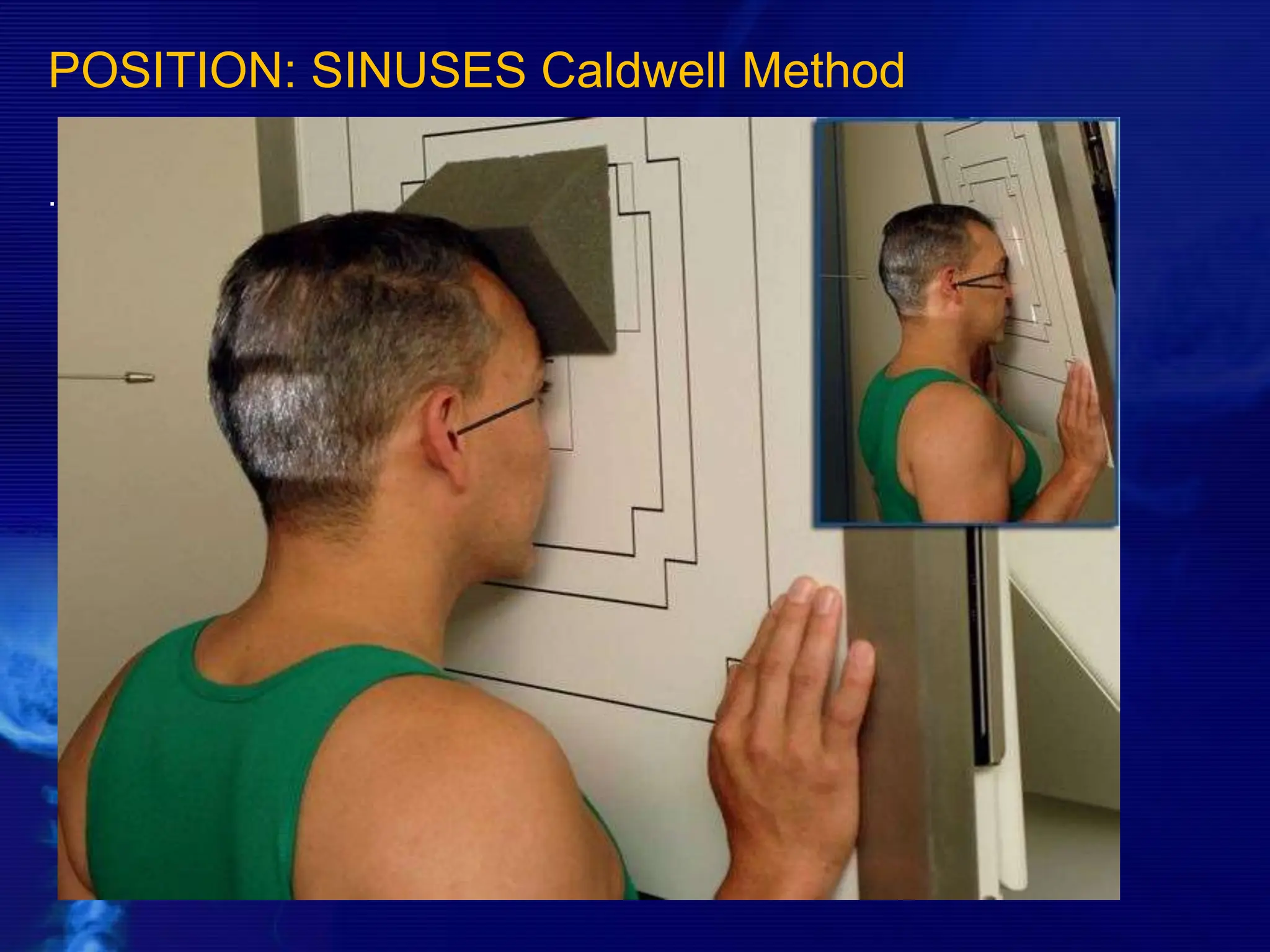 POSITION: SINUSES Caldwell Method
.
 
