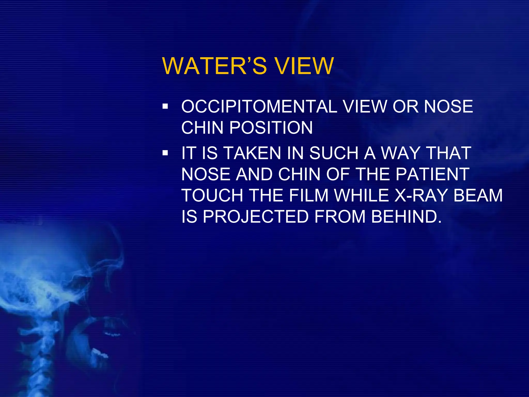 WATER’S VIEW
 OCCIPITOMENTAL VIEW OR NOSE
CHIN POSITION
 IT IS TAKEN IN SUCH A WAY THAT
NOSE AND CHIN OF THE PATIENT
TOUCH THE FILM WHILE X-RAY BEAM
IS PROJECTED FROM BEHIND.
 