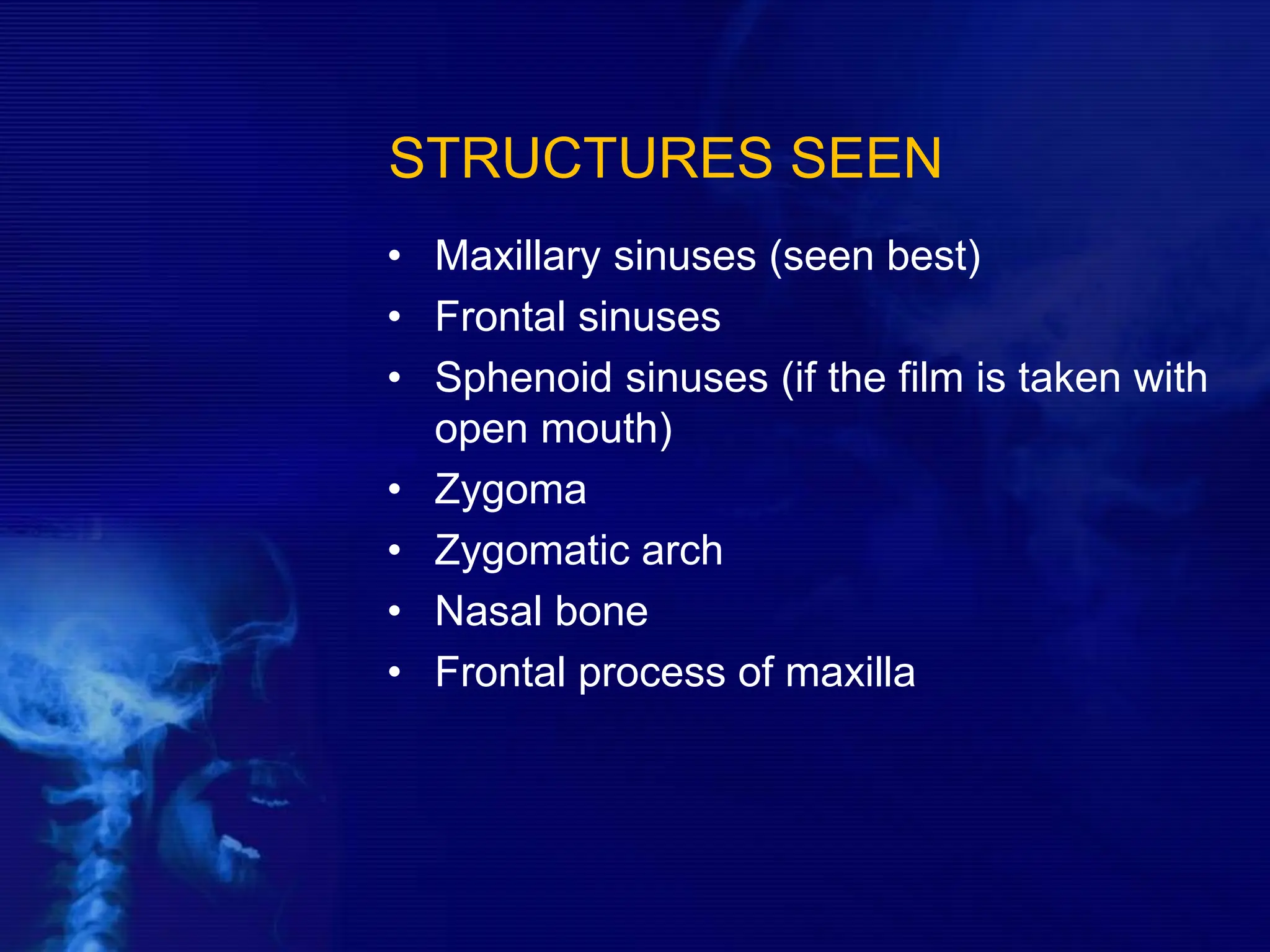 STRUCTURES SEEN
• Maxillary sinuses (seen best)
• Frontal sinuses
• Sphenoid sinuses (if the film is taken with
open mouth)
• Zygoma
• Zygomatic arch
• Nasal bone
• Frontal process of maxilla
 