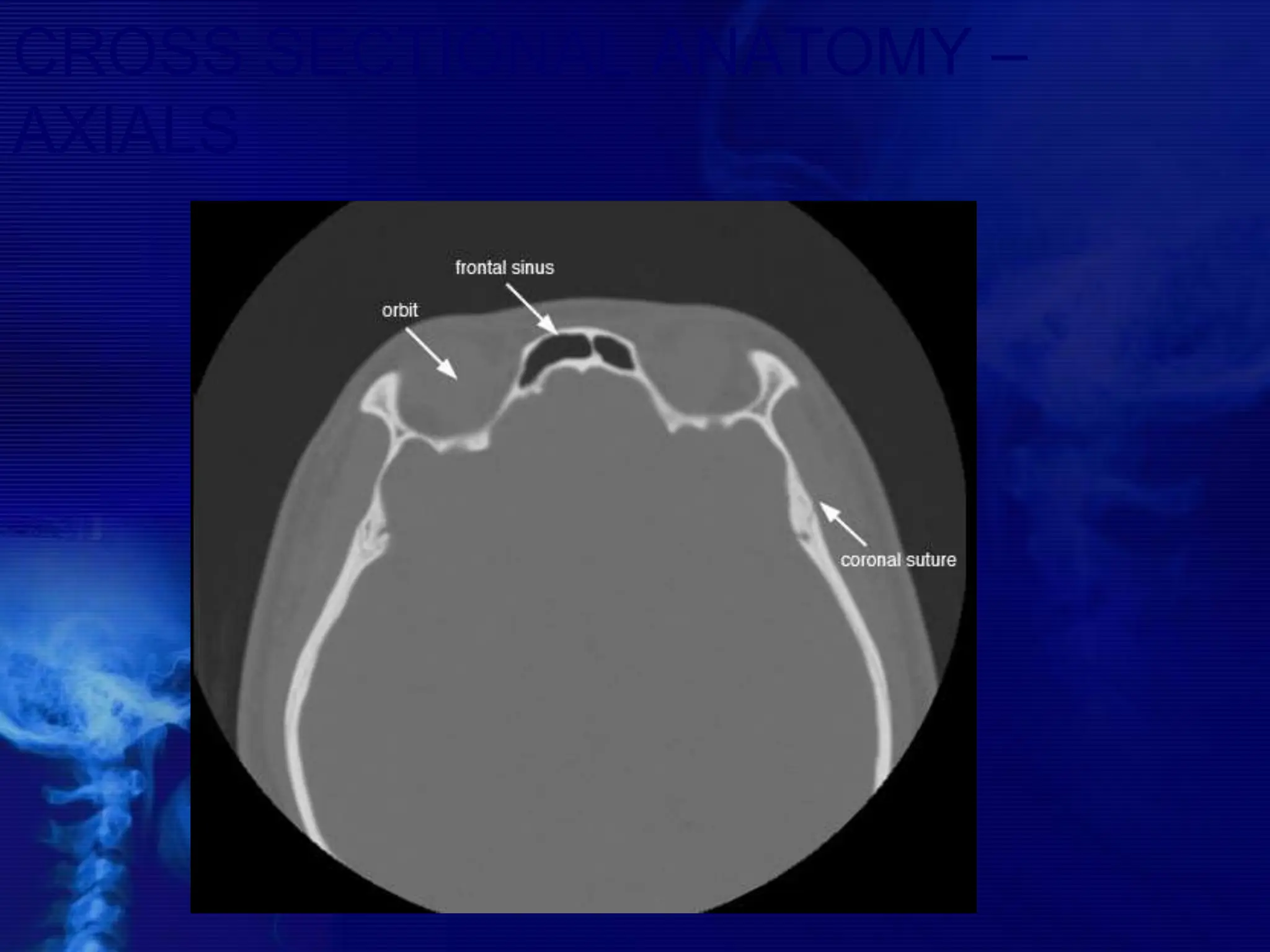 CROSS SECTIONAL ANATOMY –
AXIALS
 