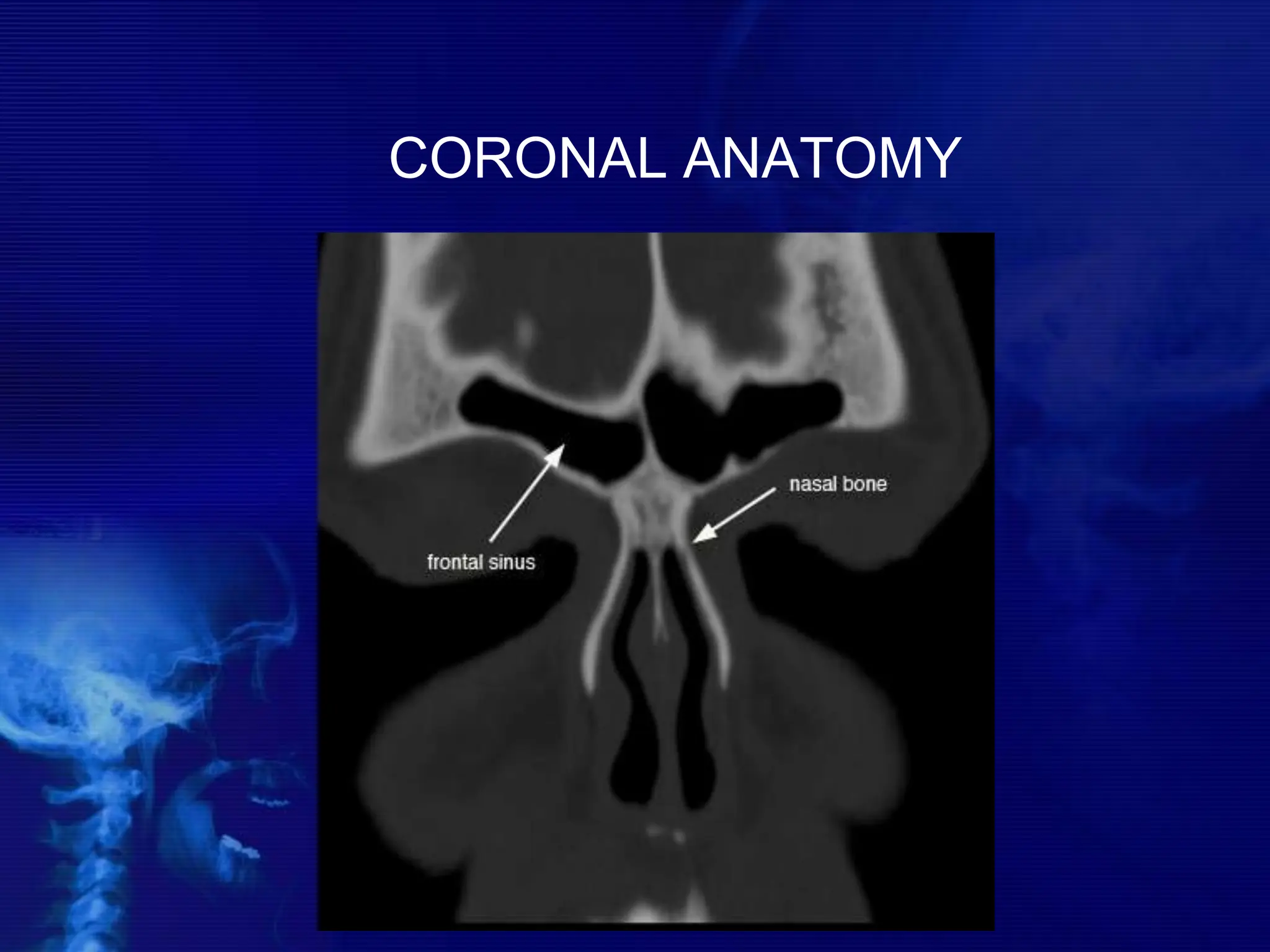 CORONAL ANATOMY
 