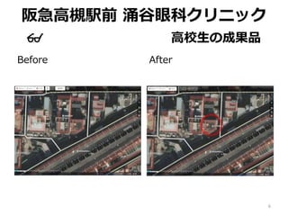 阪急高槻駅前 涌谷眼科クリニック
👓 高校生の成果品
Before After
6
 