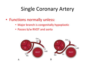 CONGENITAL CORONARY ANOMALIES AND VARIANTS, ALCAPA | PPTX