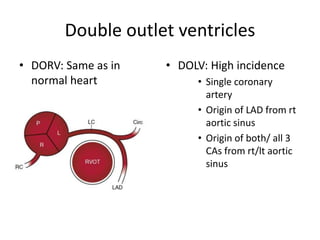 CONGENITAL CORONARY ANOMALIES AND VARIANTS, ALCAPA | PPTX