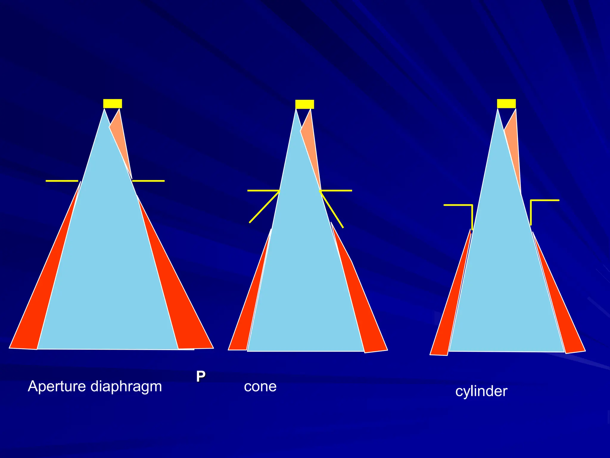 Aperture diaphragm cone cylinder
P
 