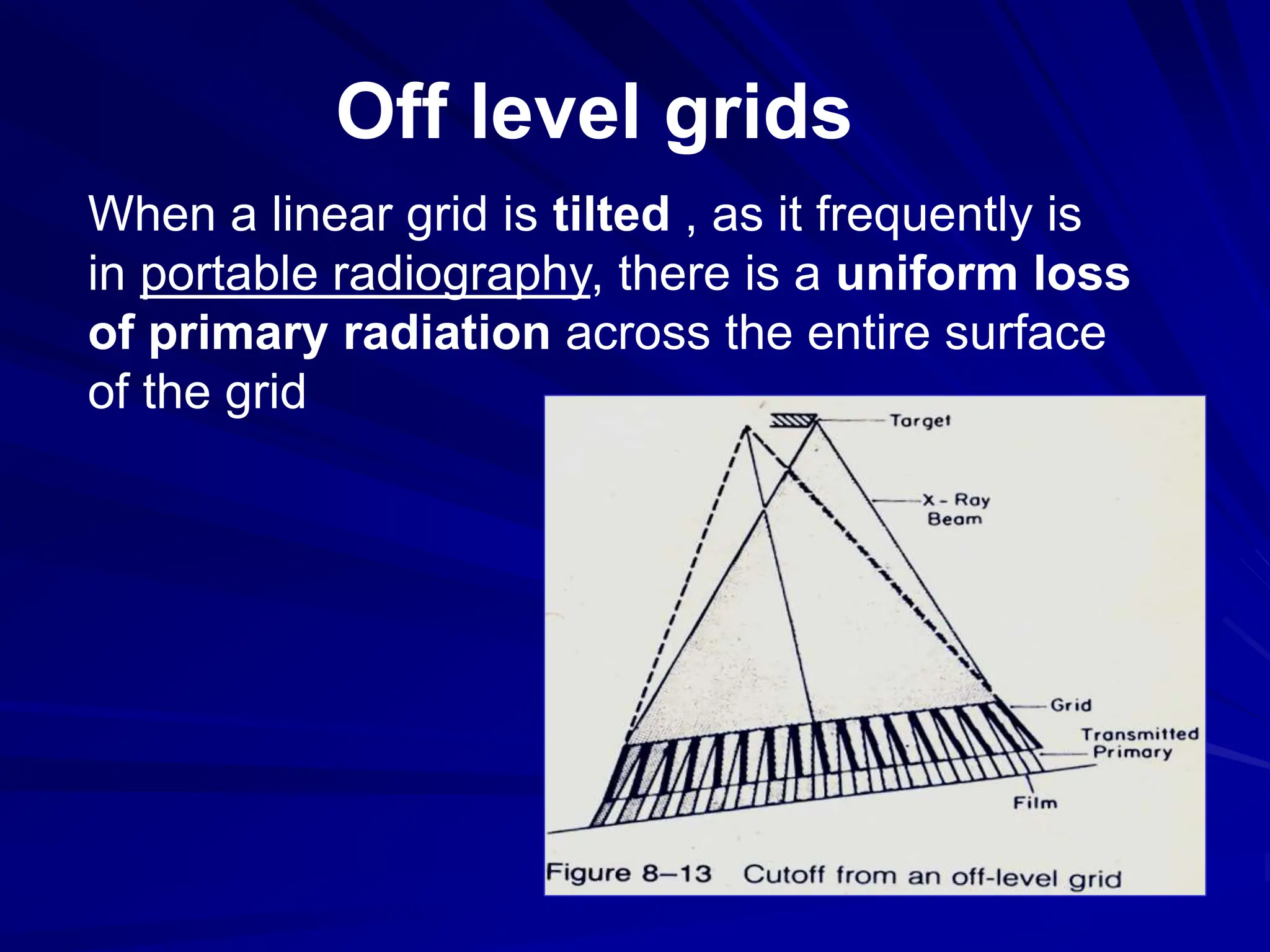 Off level grids
When a linear grid is tilted , as it frequently is
in portable radiography, there is a uniform loss
of primary radiation across the entire surface
of the grid
 