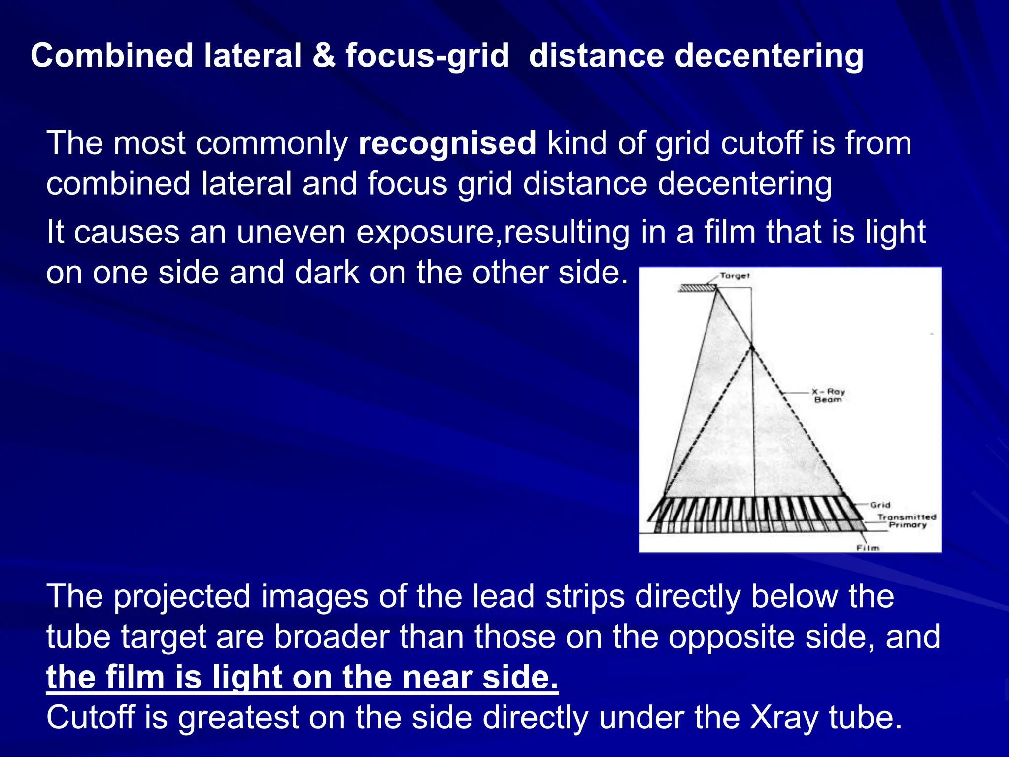 Combined lateral & focus-grid distance decentering
The most commonly recognised kind of grid cutoff is from
combined lateral and focus grid distance decentering
It causes an uneven exposure,resulting in a film that is light
on one side and dark on the other side.
The projected images of the lead strips directly below the
tube target are broader than those on the opposite side, and
the film is light on the near side.
Cutoff is greatest on the side directly under the Xray tube.
 
