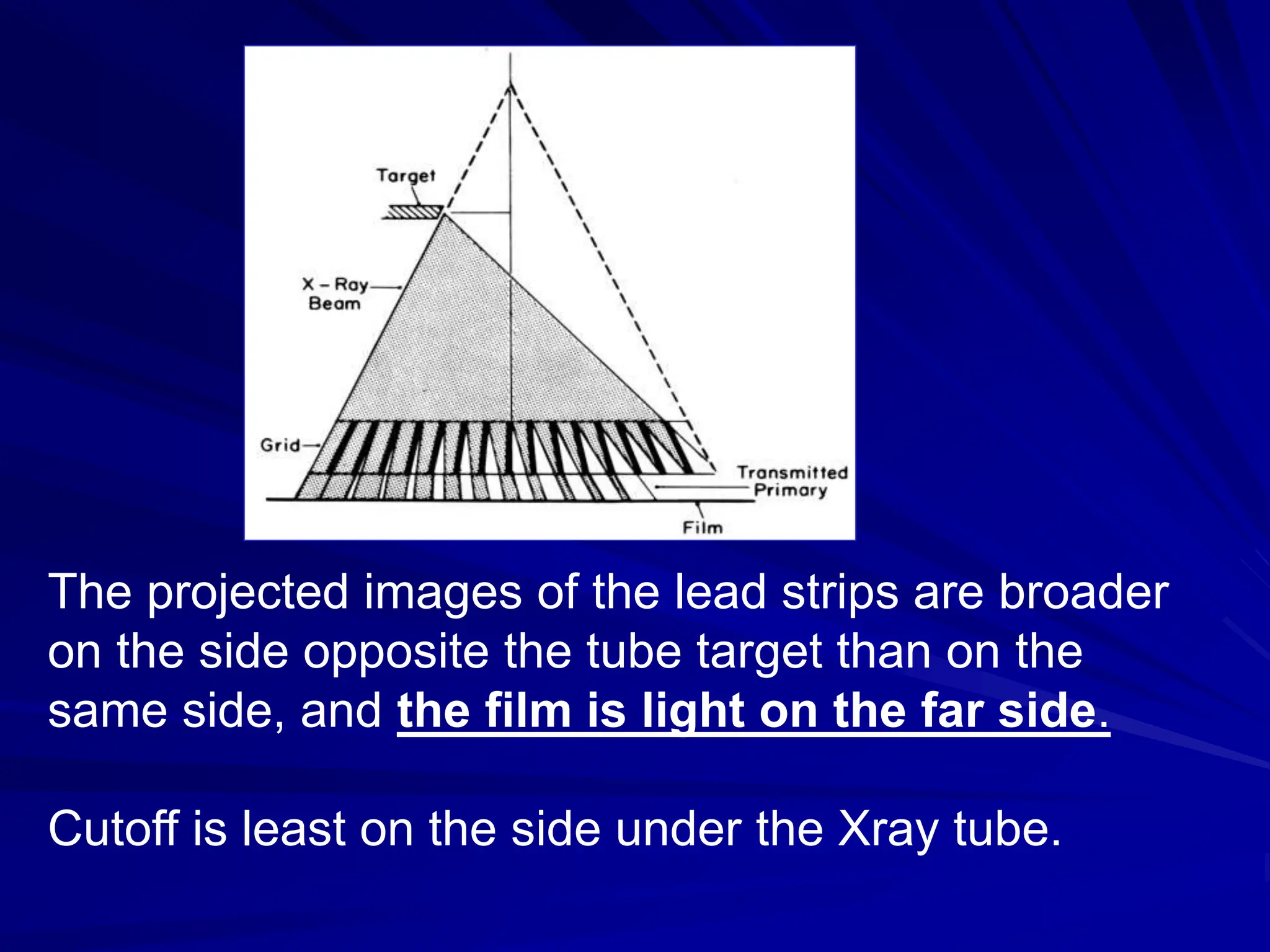 The projected images of the lead strips are broader
on the side opposite the tube target than on the
same side, and the film is light on the far side.
Cutoff is least on the side under the Xray tube.
 