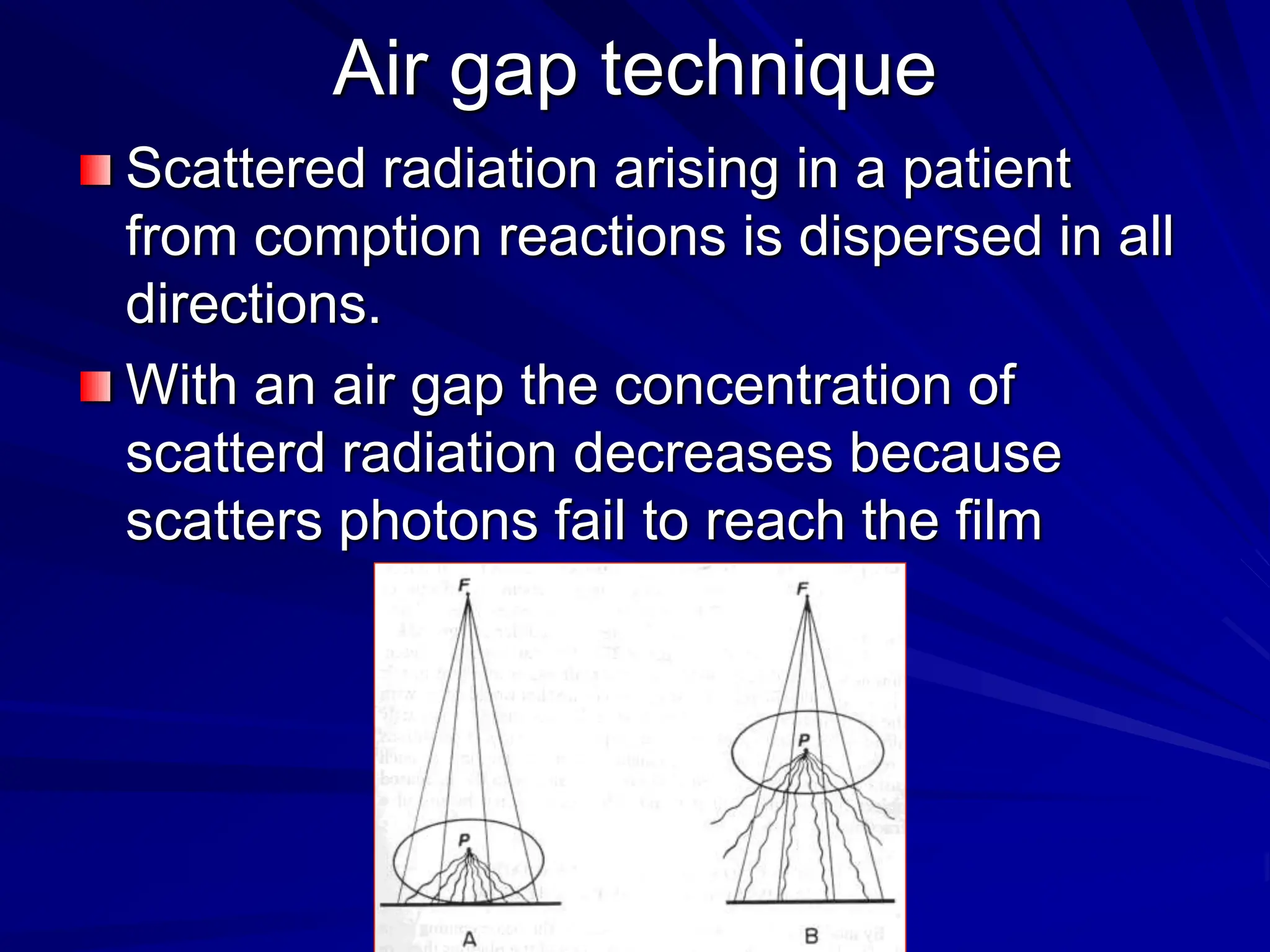 Air gap technique
Scattered radiation arising in a patient
from comption reactions is dispersed in all
directions.
With an air gap the concentration of
scatterd radiation decreases because
scatters photons fail to reach the film
 