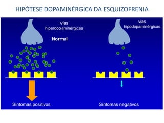 HIPÓTESE DOPAMINÉRGICA DA ESQUIZOFRENIA

 