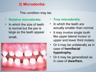 Micro Tooth developmental anomalies of teeth | PPT