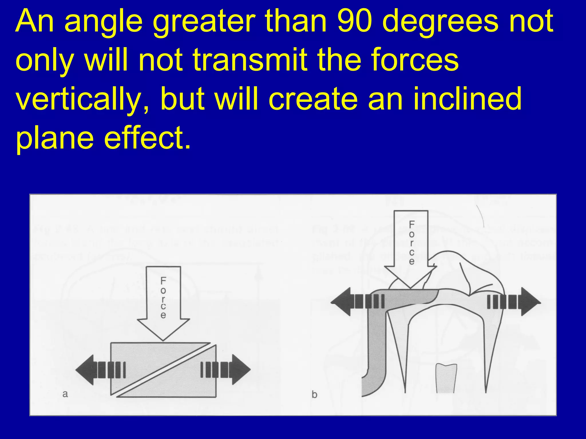 An angle greater than 90 degrees not
only will not transmit the forces
vertically, but will create an inclined
plane effect.
 