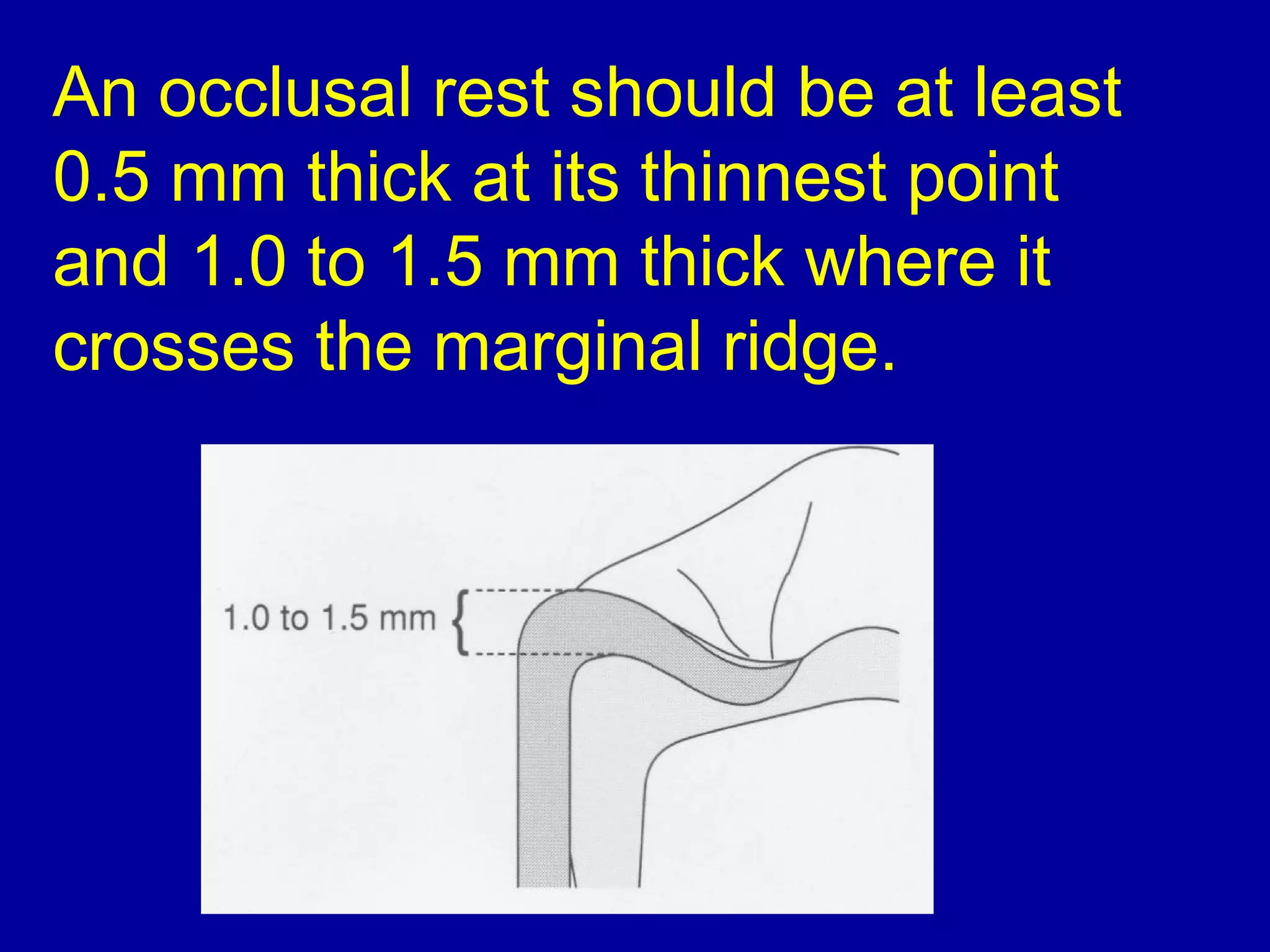 An occlusal rest should be at least
0.5 mm thick at its thinnest point
and 1.0 to 1.5 mm thick where it
crosses the marginal ridge.
 