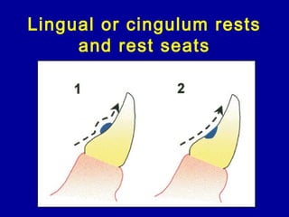 rest and rest seat | PPT