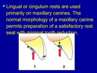 rest and rest seat | PPT