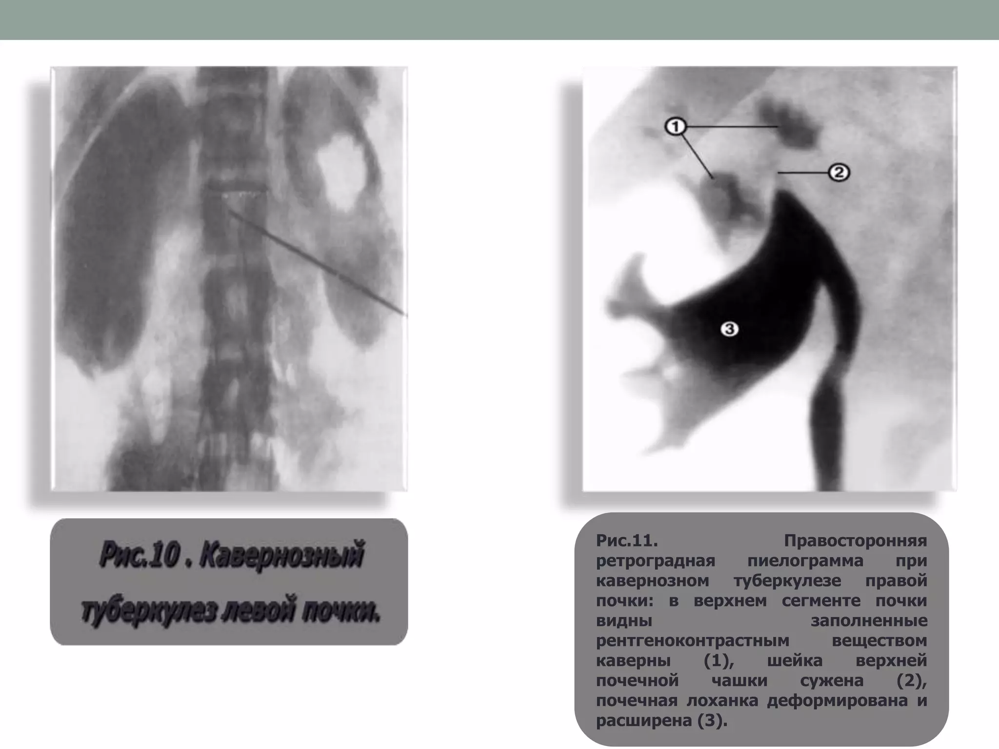 Siz mushukchani yalagan bolasiz.