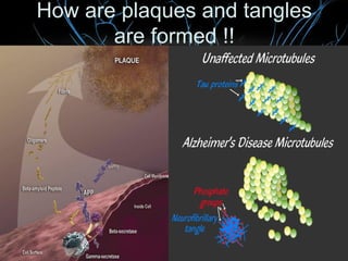 How are plaques and tangles
are formed !!

 