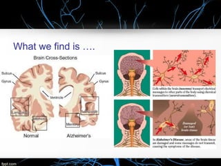 What we find is ….

 