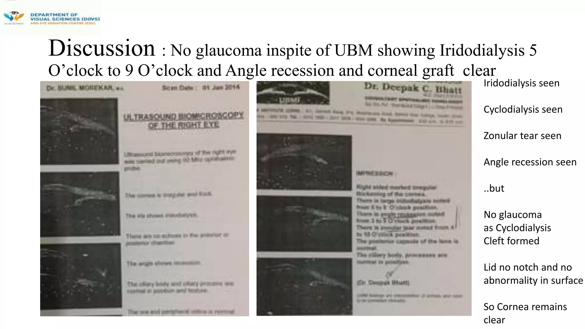 A Case Of Chopper Assault Injury Managed With Three Stage Surgical ...