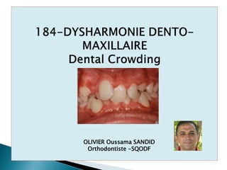 OLIVIER Oussama SANDID
Orthodontiste -SQODF
 
