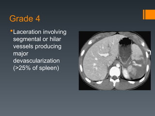 Devascularization Ct all about osteoarthritis. Detailed elaboration | PPT