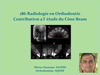IMAGERIE MEDICALE
186-Radiologie en Orthodontie
Contribution a l`étude du Cône Beam
Olivier Oussama SANDID
Orthodontiste -SQODF
 