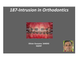 187-Intrusion in Orthodontics
Olivier Oussama SANDID
SQODF
 