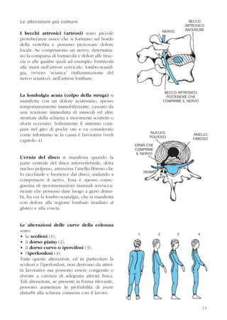 11
Le alterazioni più comuni
I becchi artrosici (artrosi) sono piccole
protuberanze ossee che si formano sul bordo
della vertebra e possono provocare dolore
locale. Se comprimono un nervo, determina-
no la comparsa di formicolii e dolori alle brac-
cia o alle gambe quali ad esempio: formicolii
alle mani nell’artrosi cervicale; lombo-sciatal-
gia, ovvero “sciatica” (infiammazione del
nervo sciatico), nell’artrosi lombare.
La lombalgia acuta (colpo della strega) si
manifesta con un dolore acutissimo, spesso
temporaneamente immobilizzante, causato da
una reazione immediata di muscoli ed altre
strutture della schiena a movimenti scorretti o
sforzi eccessivi. Solitamente il sintomo com-
pare nel giro di poche ore e va considerato
come infortunio se la causa è lavorativa (vedi
capitolo 4).
L’ernia del disco si manifesta quando la
parte centrale del disco intervertebrale, detta
nucleo polposo, attraversa l’anello fibroso che
lo racchiude e fuoriesce dal disco, andando a
comprimere il nervo. Essa è spesso conse-
guenza di movimentazioni manuali sovracca-
ricanti che possono dare luogo a gravi distur-
bi, fra cui la lombo-sciatalgia, che si manifesta
con dolore alla regione lombare irradiato al
gluteo e alla coscia.
Le alterazioni delle curve della colonna
sono:
• la scoliosi (1),
• il dorso piatto (2),
• il dorso curvo o ipercifosi (3),
• l’iperlordosi (4).
Tutte queste alterazioni, ed in particolare la
scoliosi e l’iperlordosi, non derivano da attivi-
tà lavorative ma possono essere congenite o
dovute a carenza di adeguata attività fisica.
Tali alterazioni, se presenti in forma rilevante,
possono aumentare le probabilità di avere
disturbi alla schiena connessi con il lavoro.
11
NERVO
BECCO
ARTROSICO
ANTERIORE
BECCO ARTROSICO
POSTERIORE CHE
COMPRIME IL NERVO
ANELLO
FIBROSO
NUCLEO
POLPOSO
ERNIA CHE
COMPRIME
IL NERVO
NERVO
1 2 3 4
 