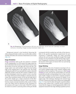 Digital Radiography And Pacs 3rd Edition 3rd Edition Beth Veale | PDF