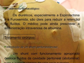Tratamento farmacológico:Tratamento farmacológico:
Os diuréticos, especialmente a Espirolactona
e a Furosemida, são úteis para reduzir a retenção
de fluídos. O médico pode ainda prescrever a
administração intravenosa de albumina.
Tratamento cirúrgico
Introdução de um shunt peritoneovenoso:Introdução de um shunt peritoneovenoso:
Um shunt com funcionamento apropriado
desloca fluídos da cavidade peritoneal (abdominal)
 