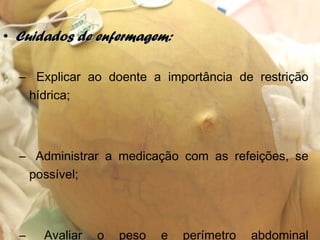 • Cuidados de enfermagem:Cuidados de enfermagem:
– Explicar ao doente a importância de restrição
hídrica;
– Administrar a medicação com as refeições, se
possível;
– Avaliar o peso e perímetro abdominal
 