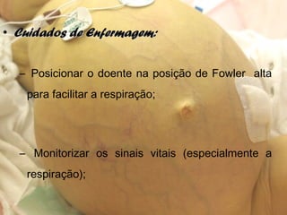 • Cuidados de Enfermagem:Cuidados de Enfermagem:
– Posicionar o doente na posição de Fowler alta
para facilitar a respiração;
– Monitorizar os sinais vitais (especialmente a
respiração);
 