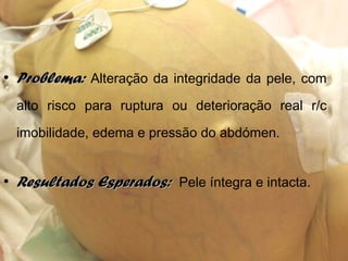 • Problema:Problema: Alteração da integridade da pele, com
alto risco para ruptura ou deterioração real r/c
imobilidade, edema e pressão do abdómen.
• Resultados Esperados:Resultados Esperados: Pele íntegra e intacta.
 