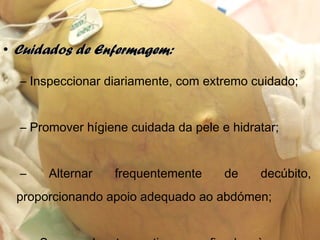 • Cuidados de Enfermagem:Cuidados de Enfermagem:
– Inspeccionar diariamente, com extremo cuidado;
– Promover hígiene cuidada da pele e hidratar;
– Alternar frequentemente de decúbito,
proporcionando apoio adequado ao abdómen;
 
