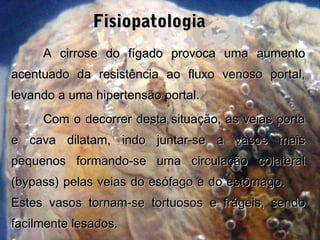 FisiopatologiaFisiopatologia
A cirrose do fígado provoca uma aumentoA cirrose do fígado provoca uma aumento
acentuado da resistência ao fluxo venoso portal,acentuado da resistência ao fluxo venoso portal,
levando a uma hipertensão portal.levando a uma hipertensão portal.
Com o decorrer desta situação, as veias portaCom o decorrer desta situação, as veias porta
e cava dilatam, indo juntar-se a vasos maise cava dilatam, indo juntar-se a vasos mais
pequenos formando-se uma circulação colateralpequenos formando-se uma circulação colateral
(bypass) pelas veias do esófago e do estômago.(bypass) pelas veias do esófago e do estômago.
Estes vasos tornam-se tortuosos e frágeis, sendoEstes vasos tornam-se tortuosos e frágeis, sendo
facilmente lesados.facilmente lesados.
 