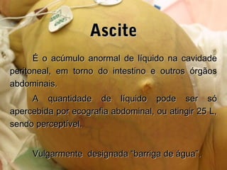 AsciteAscite
É o acúmulo anormal de líquido na cavidadeÉ o acúmulo anormal de líquido na cavidade
peritoneal, em torno do intestino e outros órgãosperitoneal, em torno do intestino e outros órgãos
abdominais.abdominais.
A quantidade de líquido pode ser sóA quantidade de líquido pode ser só
apercebida por ecografia abdominal, ou atingir 25 L,apercebida por ecografia abdominal, ou atingir 25 L,
sendo perceptível.sendo perceptível.
Vulgarmente designada “barriga de água”.Vulgarmente designada “barriga de água”.
 