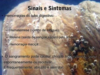 • Hemorragias do tubo digestivo:Hemorragias do tubo digestivo:
– Hematemese (vómito de sangue);Hematemese (vómito de sangue);
– Melena (saída de sangue escuro pelo ânus);Melena (saída de sangue escuro pelo ânus);
– Hemorragia maciça.Hemorragia maciça.
• O sangramento pode causar choque hipovolémico, pararO sangramento pode causar choque hipovolémico, parar
espontaneamente ou recidivar.espontaneamente ou recidivar.
É frequentemente, abrupto e sem dor.É frequentemente, abrupto e sem dor.
Sinais e SintomasSinais e Sintomas
 