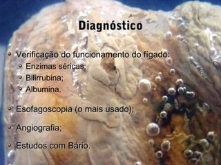 DiagnósticoDiagnóstico
Verificação do funcionamento do fígado:Verificação do funcionamento do fígado:
Enzimas séricas;
Bilirrubina;
Albumina.
Esofagoscopia (o mais usado);Esofagoscopia (o mais usado);
Angiografia;Angiografia;
Estudos com Bário.Estudos com Bário.
 