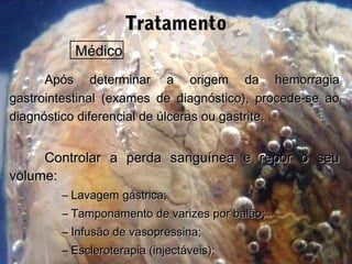TratamentoTratamento
MédicoMédico
Após determinar a origem da hemorragiaApós determinar a origem da hemorragia
gastrointestinal (exames de diagnóstico), procede-se aogastrointestinal (exames de diagnóstico), procede-se ao
diagnóstico diferencial de úlceras ou gastrite.diagnóstico diferencial de úlceras ou gastrite.
Controlar a perda sanguínea e repor o seuControlar a perda sanguínea e repor o seu
volume:volume:
– Lavagem gástrica;Lavagem gástrica;
– Tamponamento de varizes por balão;Tamponamento de varizes por balão;
– Infusão de vasopressina;Infusão de vasopressina;
– Escleroterapia (injectáveis);Escleroterapia (injectáveis);
 