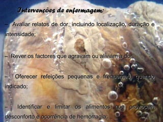 Intervenções de enfermagem:Intervenções de enfermagem:
– Avaliar relatos de dor, incluindo localização, duração eAvaliar relatos de dor, incluindo localização, duração e
intensidade;intensidade;
– Rever os factores que agravam ou aliviam a dor;Rever os factores que agravam ou aliviam a dor;
– Oferecer refeições pequenas e frequentes, quandoOferecer refeições pequenas e frequentes, quando
indicado;indicado;
– Identificar e limitar os alimentos que provocamIdentificar e limitar os alimentos que provocam
desconforto e ocorrência de hemorragia;desconforto e ocorrência de hemorragia;
 