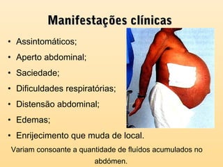 Manifestações clínicasManifestações clínicas
• Assintomáticos;
• Aperto abdominal;
• Saciedade;
• Dificuldades respiratórias;
• Distensão abdominal;
• Edemas;
• Enrijecimento que muda de local.
Variam consoante a quantidade de fluídos acumulados no
abdómen.
 