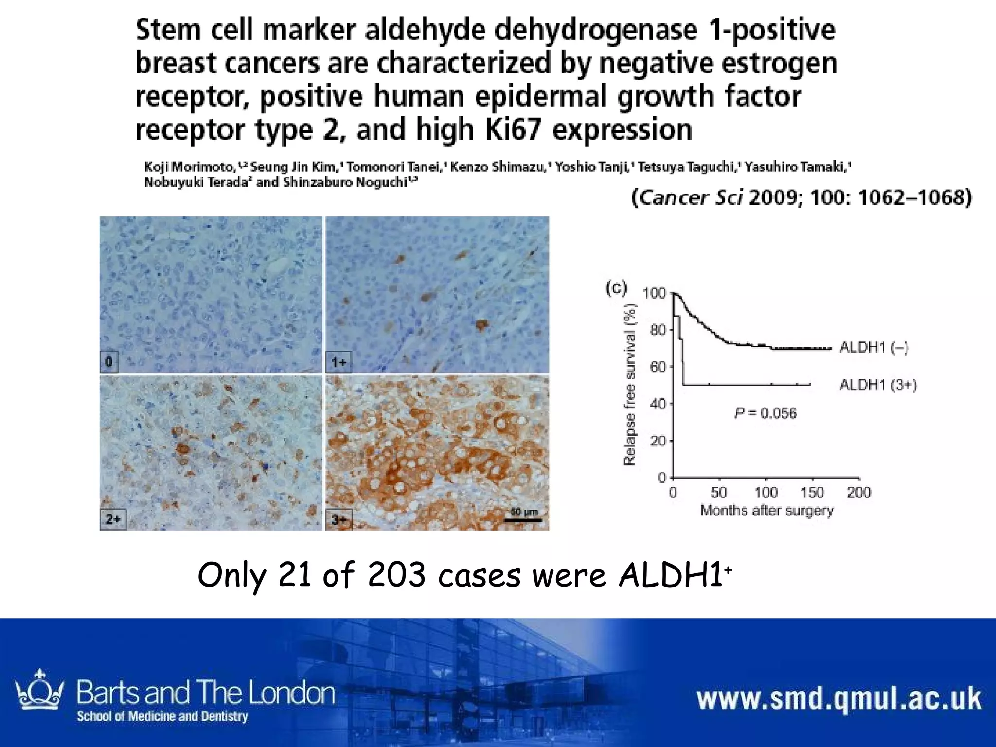 Only 21 of 203 cases were ALDH1 + 