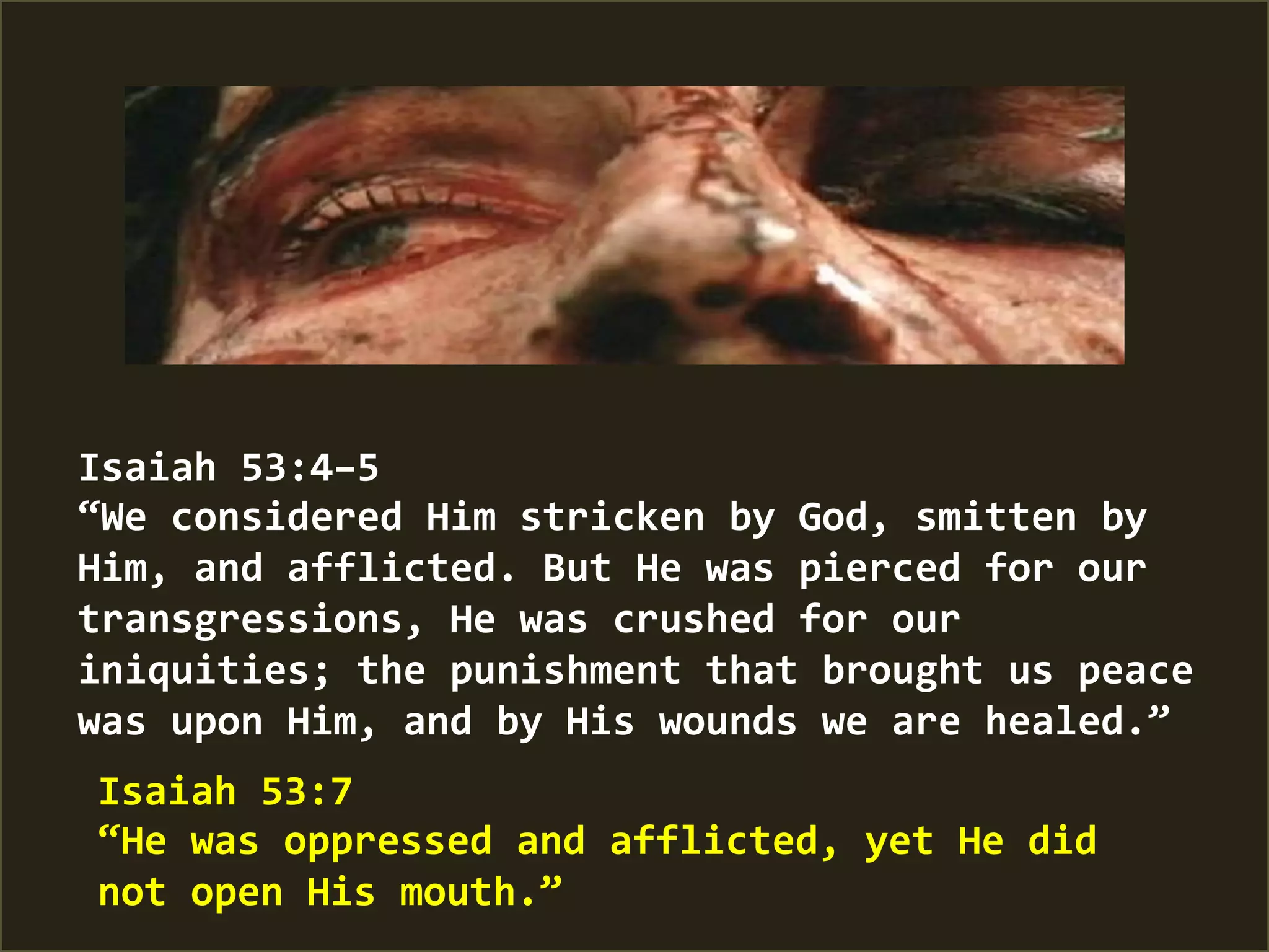 Isaiah	
  53:4–5	
  
“We	
  considered	
  Him	
  stricken	
  by	
  God,	
  smitten	
  by	
  
Him,	
  and	
  afflicted.	
  But	
  He	
  was	
  pierced	
  for	
  our	
  
transgressions,	
  He	
  was	
  crushed	
  for	
  our	
  
iniquities;	
  the	
  punishment	
  that	
  brought	
  us	
  peace	
  
was	
  upon	
  Him,	
  and	
  by	
  His	
  wounds	
  we	
  are	
  healed.”	
  
Isaiah	
  53:7	
  
“He	
  was	
  oppressed	
  and	
  afflicted,	
  yet	
  He	
  did	
  
not	
  open	
  His	
  mouth.”	
  
 
