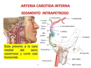 ARTERIA CAROTIDA INTERNA
SEGMENTO INTRAPETROSO
Esta próximo a la cara
medial del seno
cavernoso y corre casi
horizontal.
DAVID SUMERENTE TORRES
 
