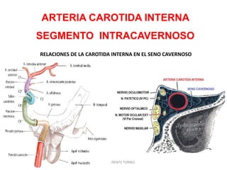 ARTERIA CAROTIDA INTERNA
SEGMENTO INTRACAVERNOSO
RELACIONES DE LA CAROTIDA INTERNA EN EL SENO CAVERNOSO
DAVID SUMERENTE TORRES
 