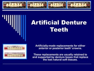 Artificial Denture
Teeth
Artificially-made replacements for either
anterior or posterior teeth' crowns.
These replacements are usually retained to
and supported by denture bases that replace
the lost natural soft tissues.
 