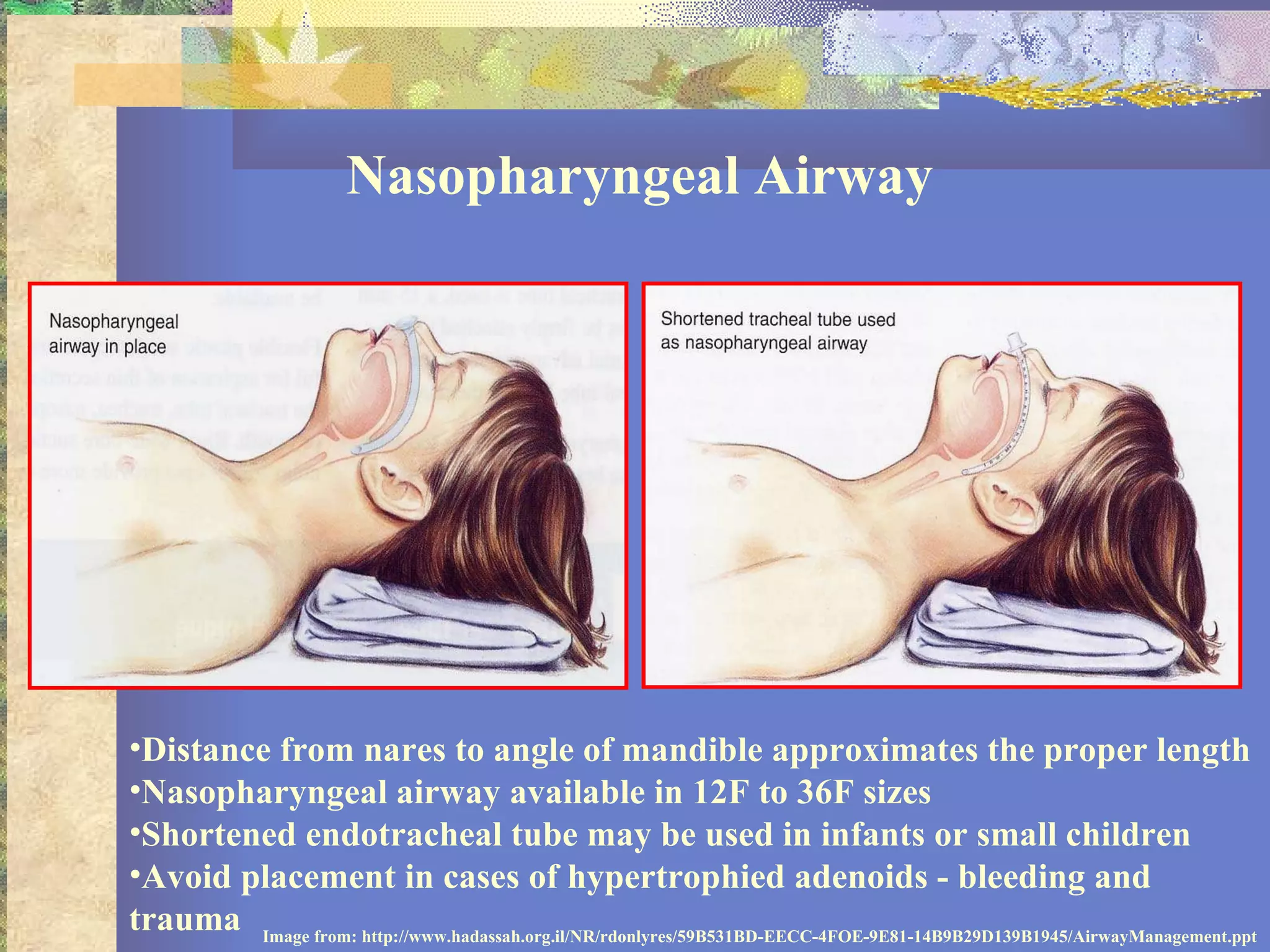 18 basics of pediatric airway anatomy, physiology and management | PPT