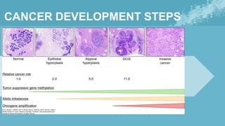 18) Benign and Malignant Diseases of Breast .pdf
