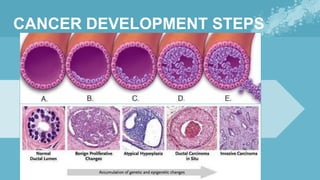 18) Benign and Malignant Diseases of Breast .pdf